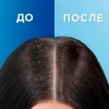 Шампунь против перхоти "Head & Shoulders" 2в1 Основной уход 200 мл